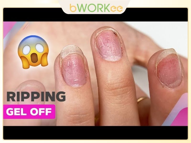 Vì Sao Nên Gỡ Sơn Gel Đúng Cách?